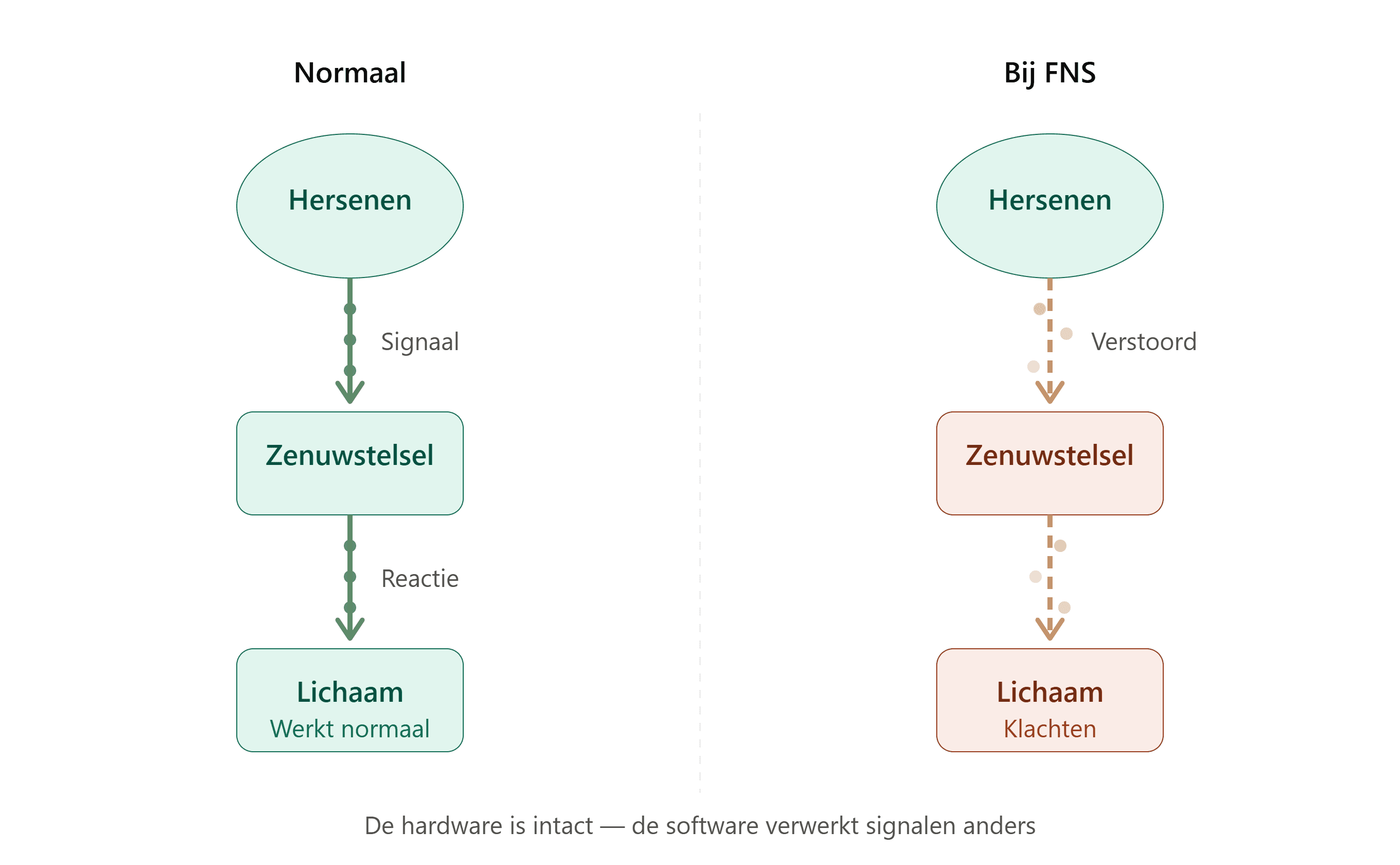 Vergelijking tussen normale signaaloverdracht (hersenen → zenuwstelsel → lichaam) en bij FNS, waar het zenuwstelsel de signalen verstoord doorgeeft terwijl de hardware intact is.